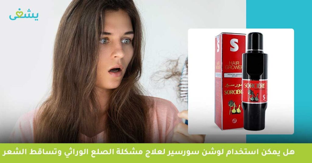 هل يمكن استخدام لوشن سورسير لعلاج مشكلة الصلع الوراثي وتساقط الشعر ؟