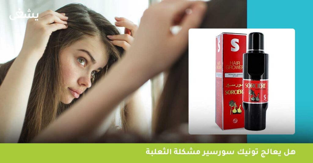 هل يعالج تونيك سورسير مشكلة الثعلبة ؟