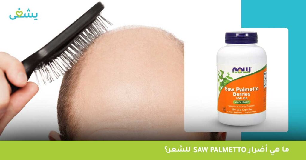 ما هي أضرار Saw palmetto للشعر؟
