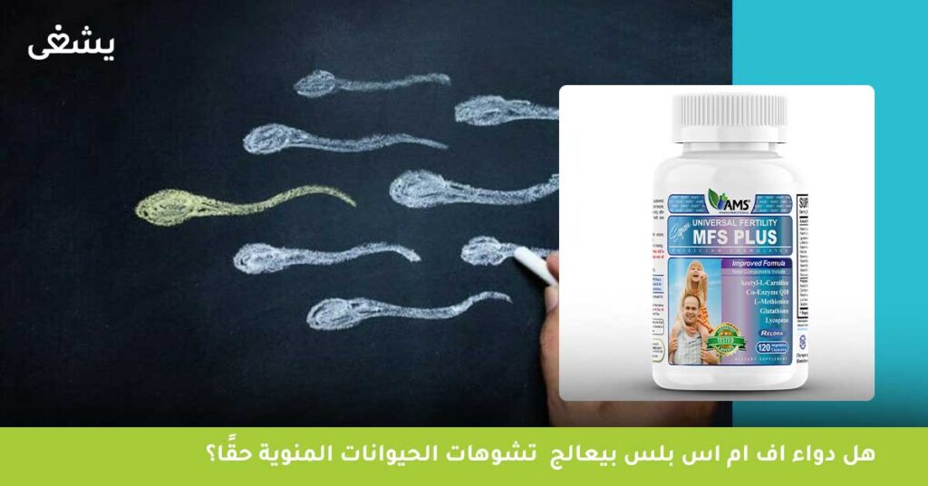 هل دواء اف ام اس بلس بيعالج  تشوهات الحيوانات المنوية حقًا؟