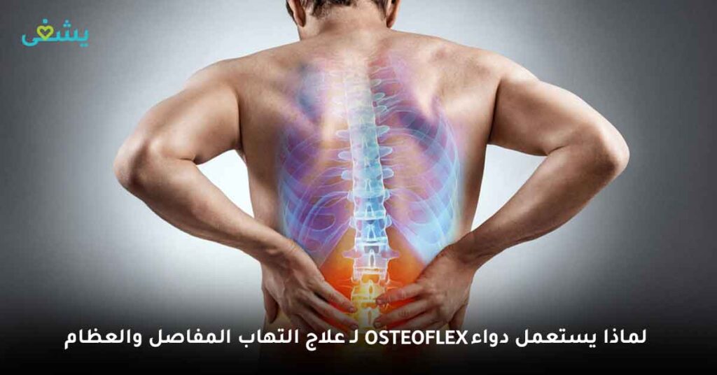 لماذا يستعمل دواء Osteoflex لـ علاج التهاب المفاصل والعظام؟