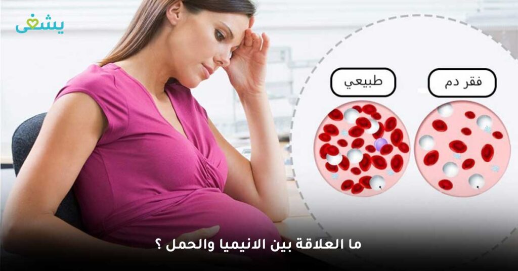 ما هي أسباب فقر الدم اثناء الحمل؟