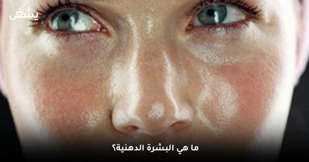  ما هي البشرة الدهنية؟