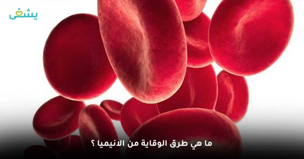 ما هي طرق الوقاية من الانيميا ؟