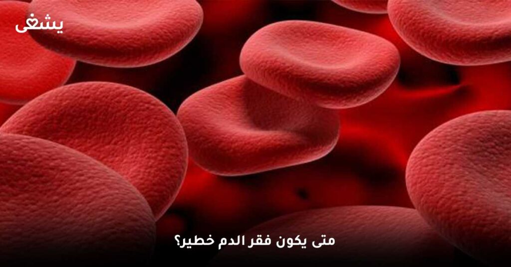 متى يكون فقر الدم خطير؟