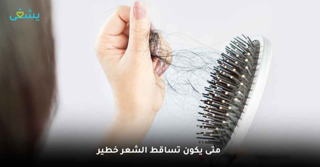 متى يكون تساقط الشعر خطير ؟
