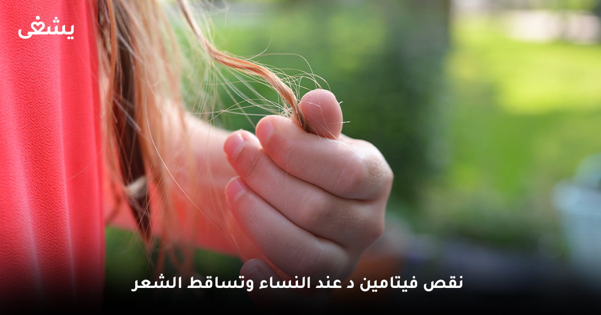 نقص فيتامين د عند النساء وتساقط الشعر