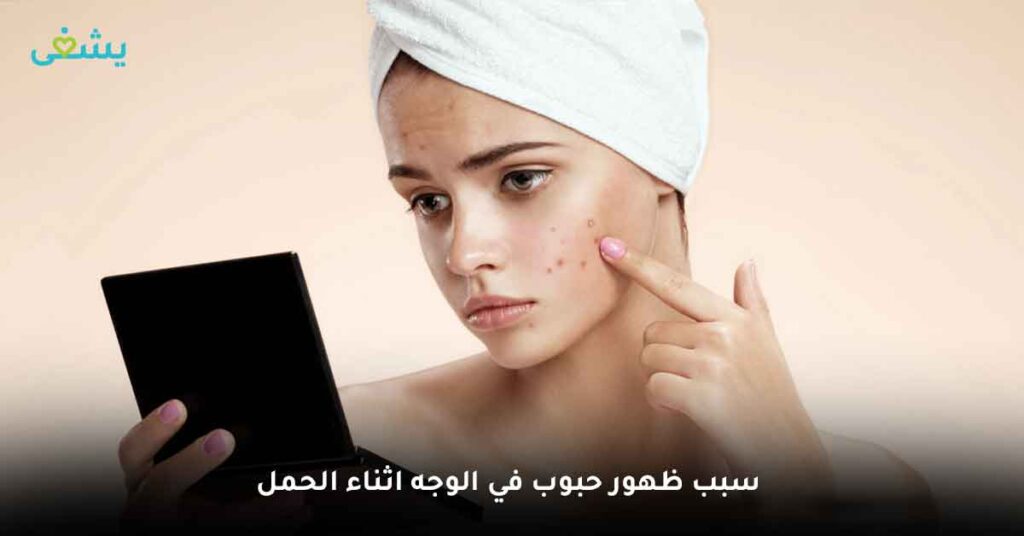 ما سبب ظهور حبوب في الوجه اثناء الحمل ؟