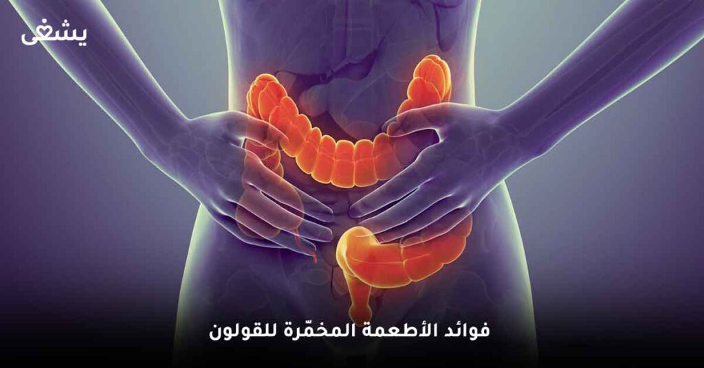 فوائد الأطعمة المخمّرة للقولون