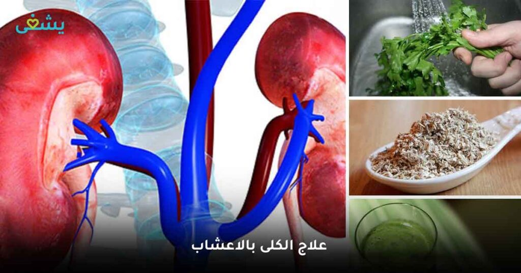 علاج الكلى بالاعشاب
