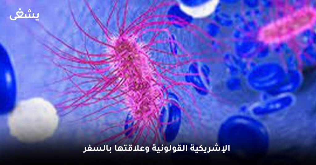 الإشريكية القولونية وعلاقتها بالسفر