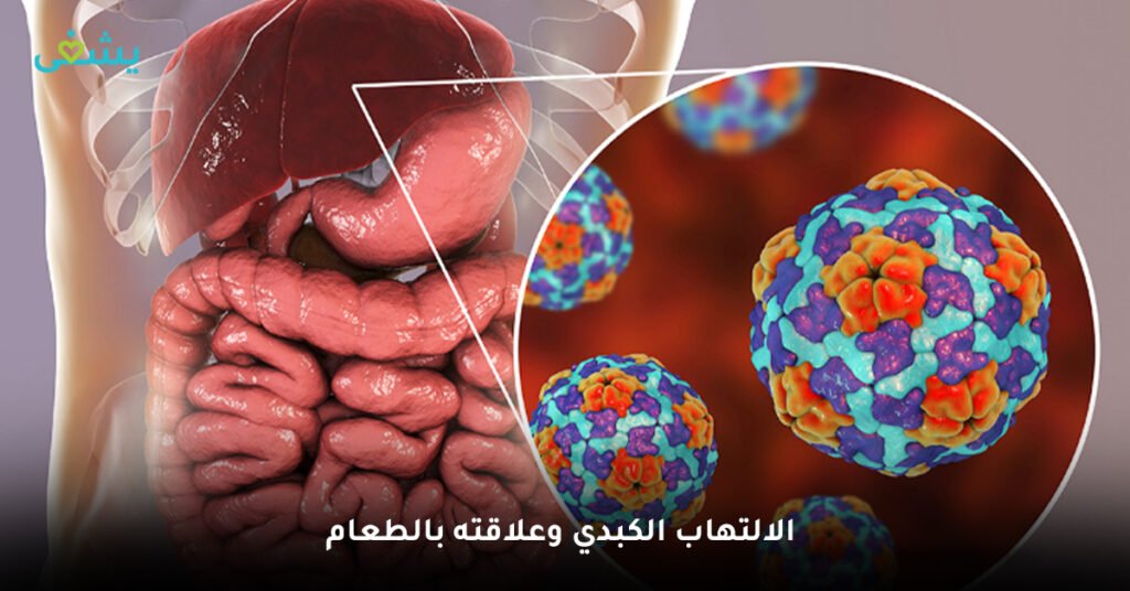 الالتهاب الكبدي وعلاقته بالطعام