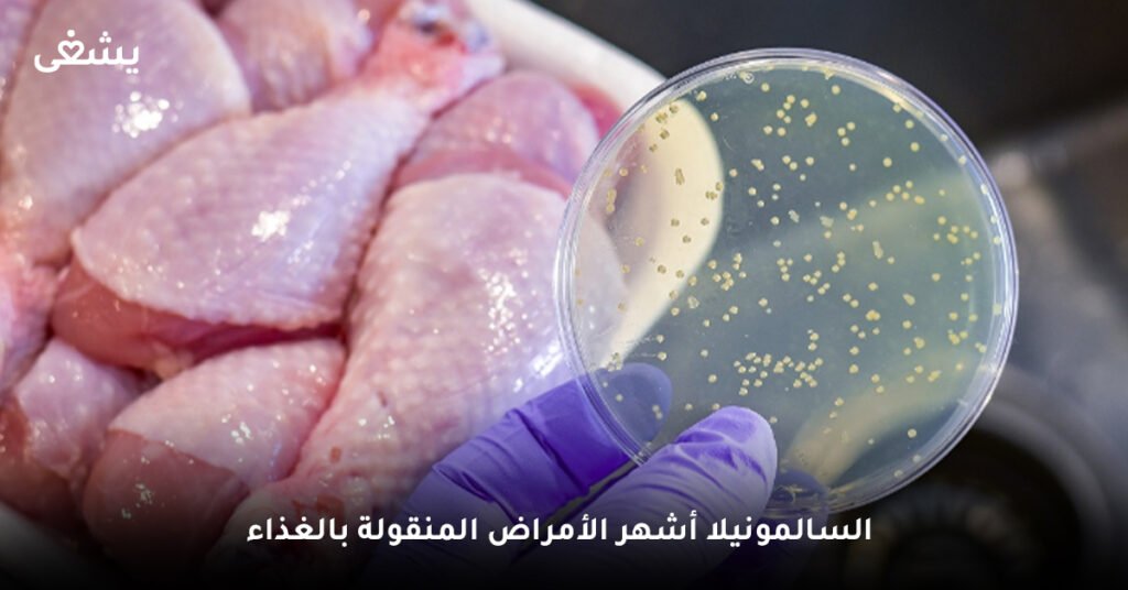 السالمونيلا أشهر الأمراض المنقولة بالغذاء