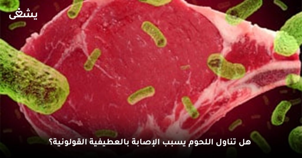 هل تناول اللحوم يسبب الإصابة بالعطفية القولونية؟