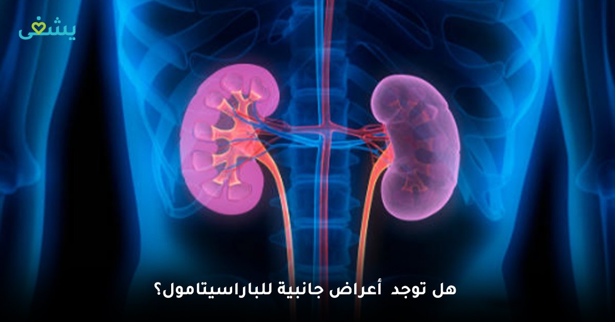 تأثير البارسيتامول على الكلى