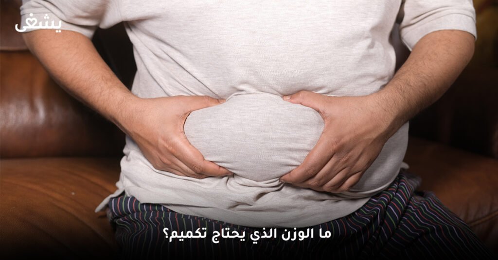 ما الوزن الذي يحتاج تكميم؟