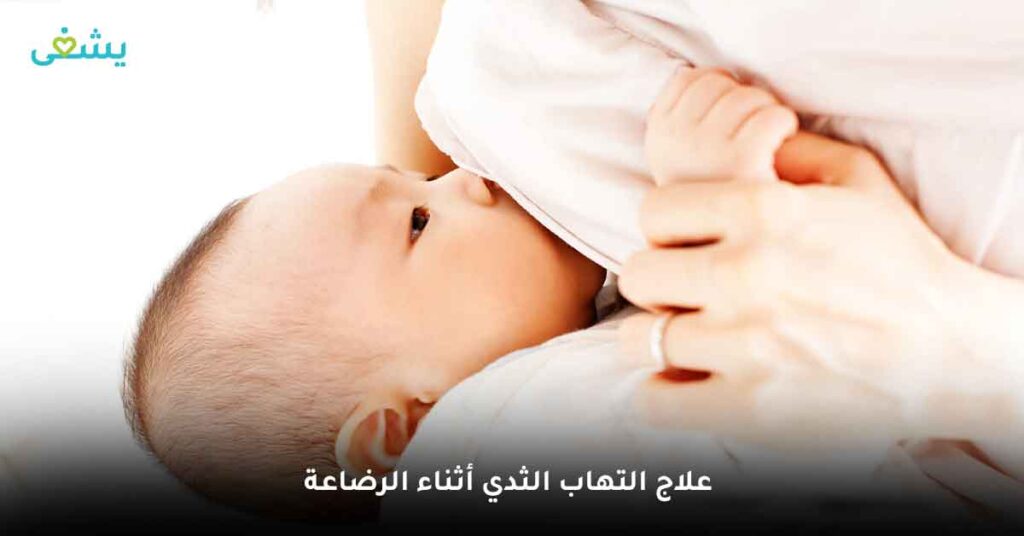 علاج التهاب الثدي أثناء الرضاعة
