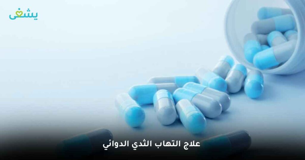 علاج التهاب الثدي الدوائي