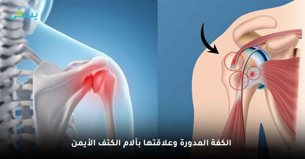 الكفة المدورة وعلاقتها بآلام الكتف الأيمن