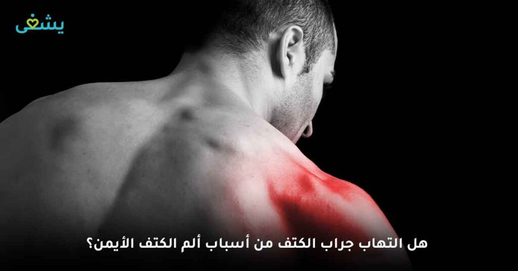 هل التهاب جراب الكتف من أسباب ألم الكتف الأيمن؟