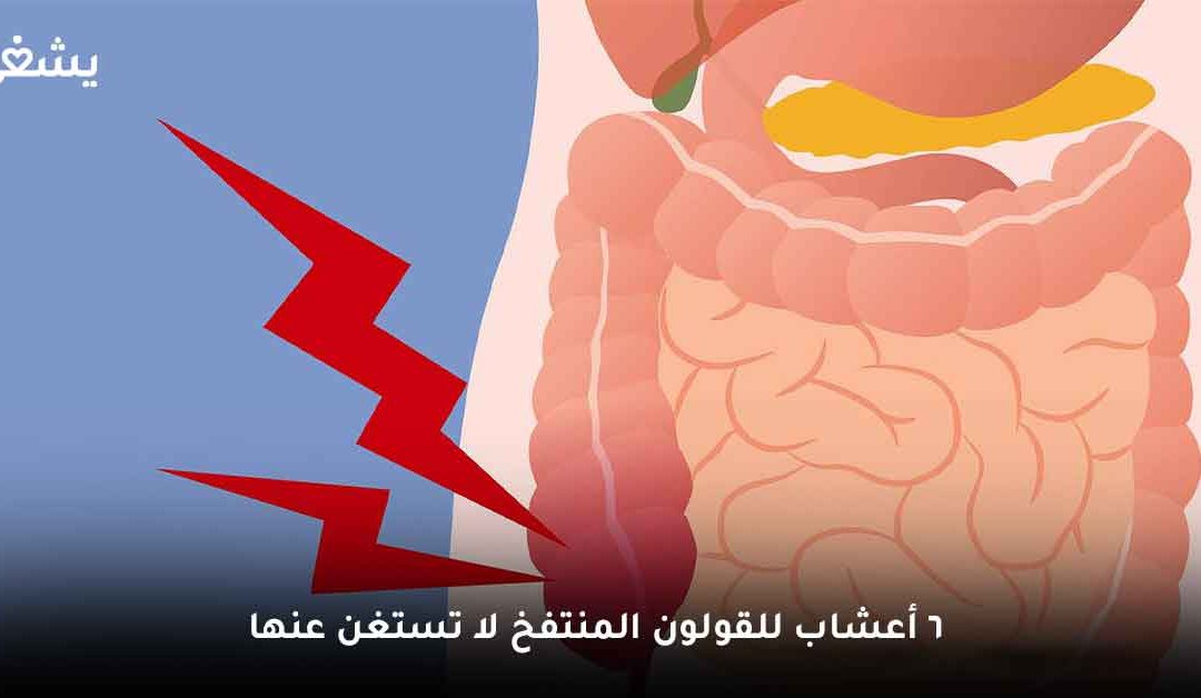 أعشاب للقولون المنتفخ سريعة المفعول