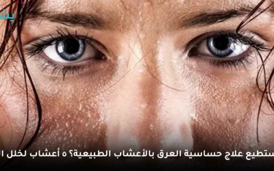 هل أستطيع علاج حساسية العرق بالأعشاب الطبيعية؟ 5 أعشاب لمكافحة خلل التعرق