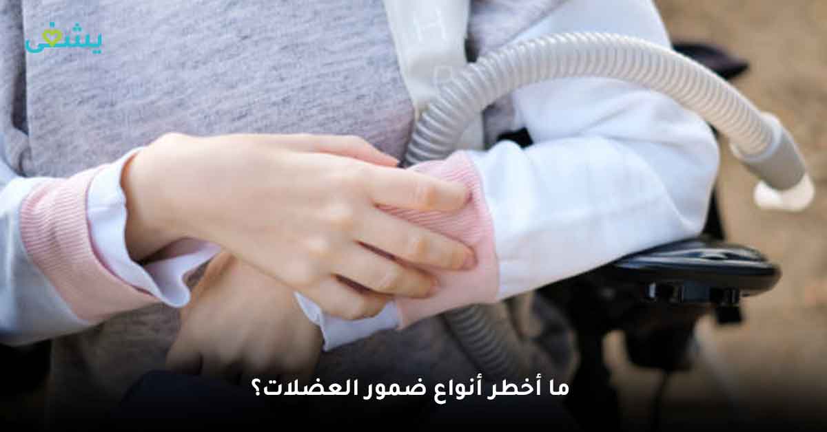 ما أخطر أنواع ضمور العضلات؟