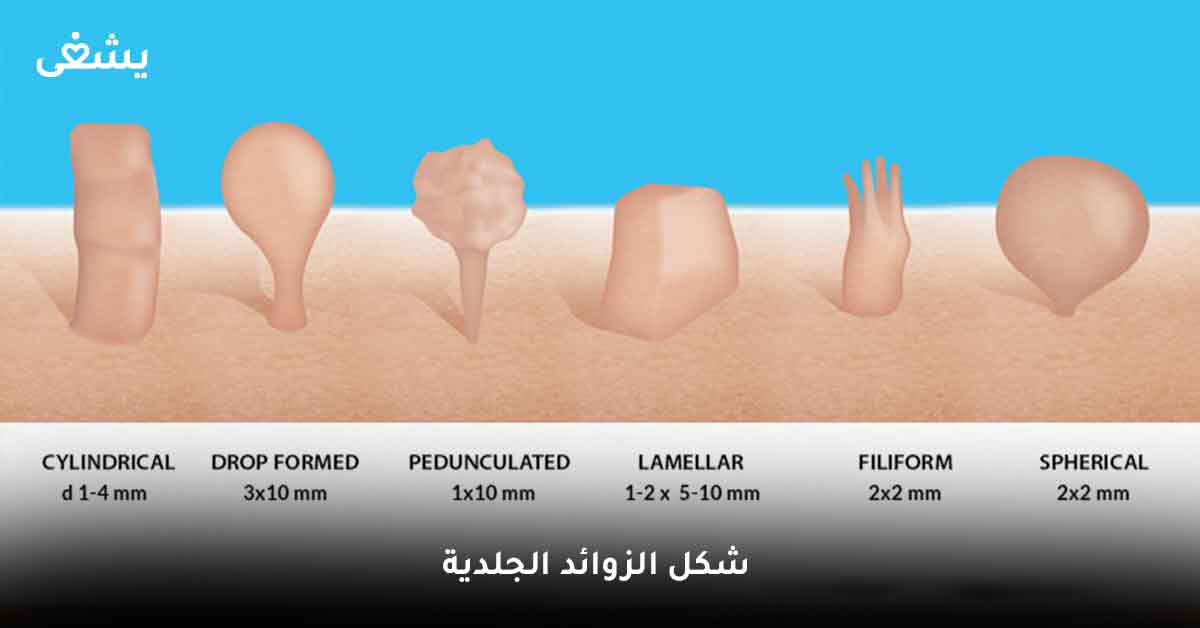 شكل الزوائد الجلدية