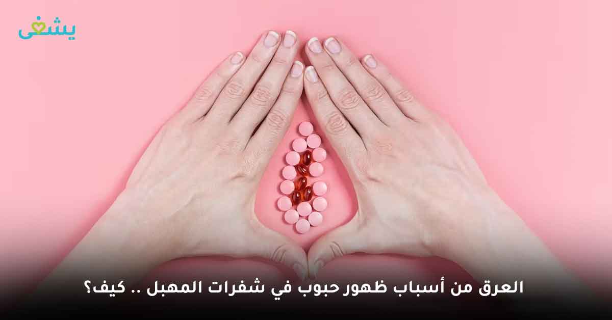 العرق من أسباب ظهور حبوب في شفرات المهبل .. كيف؟